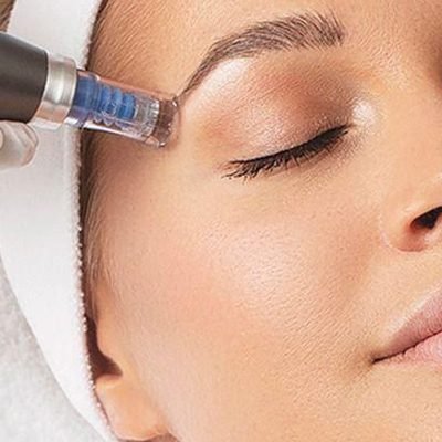 dermapen