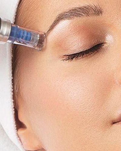 dermapen