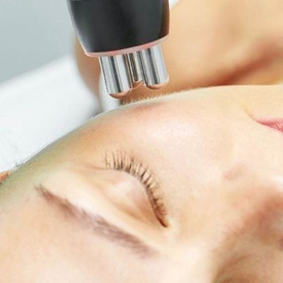 radiofrecuencia-facial