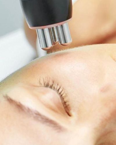 radiofrecuencia-facial
